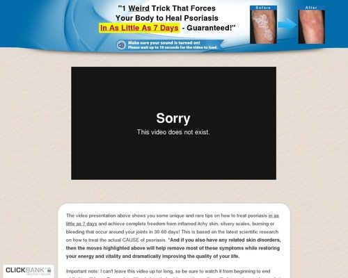 Psoriasis Revolution Video – Heal Psoriasis In 7 Days Psoriasis Revolution Video – Heal Psoriasis In 7 Days