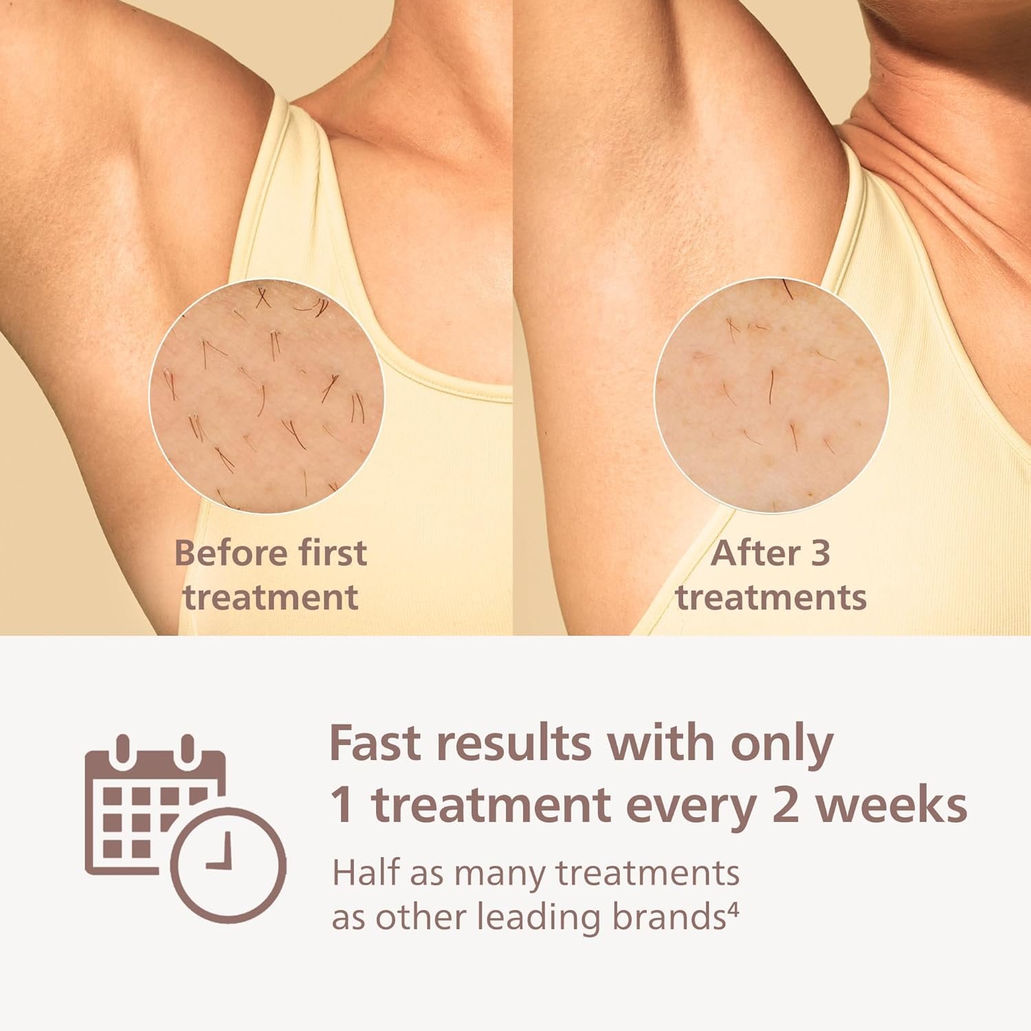 Philips Lumea 9000 Series IPL Hair Removal Device, Visible Permanent Laser Hair Reduction Done at Home, for Women & Men, SenseIQ Technology, 4 Attachments for Body, Face, Bikini & Underarms, BRI984/03 - Image 5